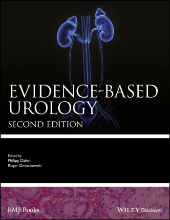 Evidence-based Urology
