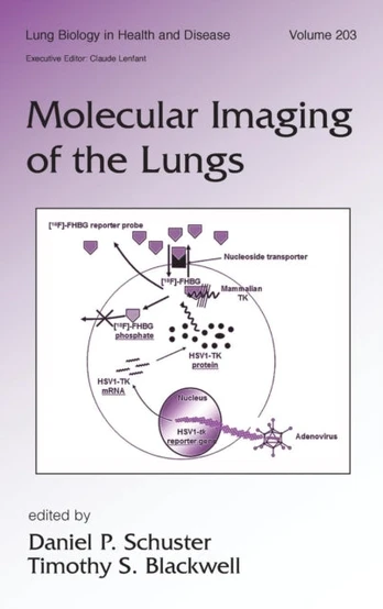 Molecular Imaging of the Lungs