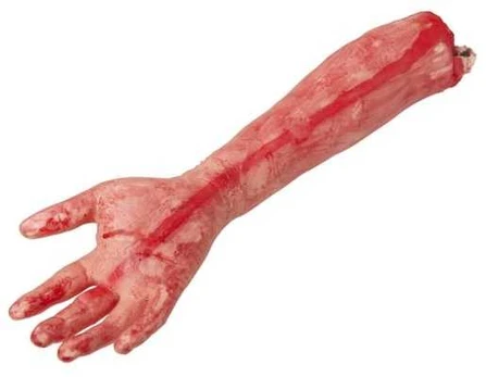 Widmann Blodig afrevet arm