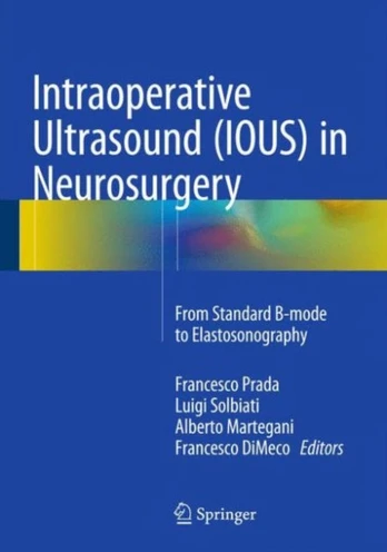 Intraoperative Ultrasound (IOUS) in Neurosurgery