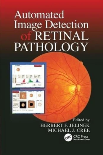 Automated Image Detection of Retinal Pathology