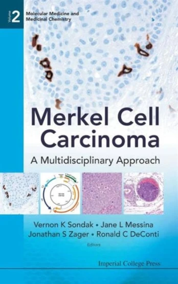Merkel Cell Carcinoma: A Multidisciplinary Approach