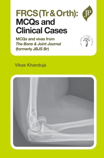 FRCS(Tr & Orth): MCQs and Clinical Cases