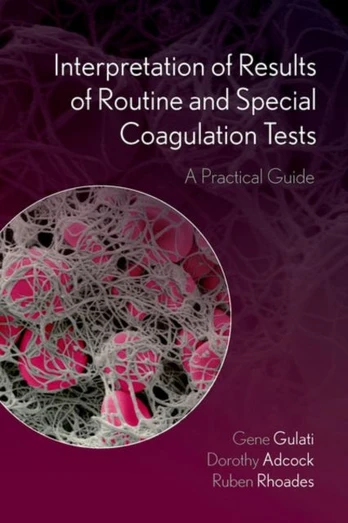 Interpretation of Results of Routine and Special Coagulation Tests