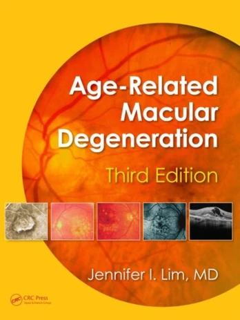 Age-Related Macular Degeneration, Third Edition