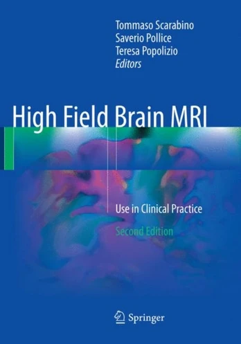High Field Brain MRI