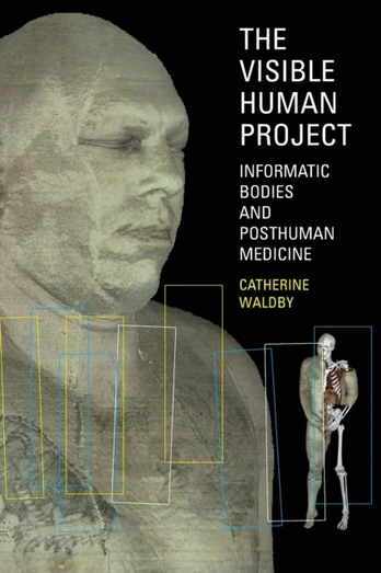 Visible Human Project
