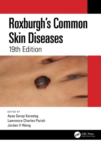 Roxburgh's Common Skin Diseases