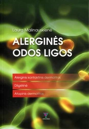 Alerginės odos ligos