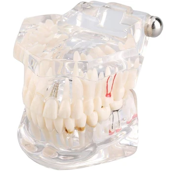 Verk Group Dental modelis jaw teeth teeth implants