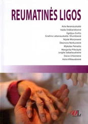 Reumatinės ligos