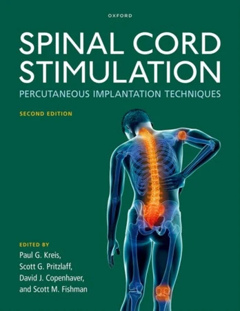 Spinal Cord Stimulation
