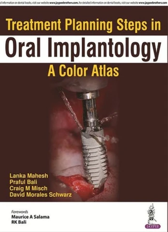 Treatment Planning Steps in Oral Implantology