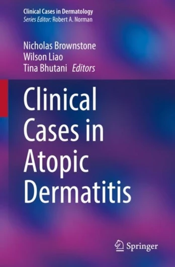 Clinical Cases in Atopic Dermatitis