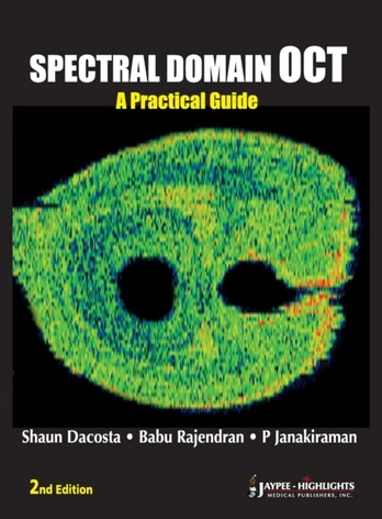 Spectral Domain OCT