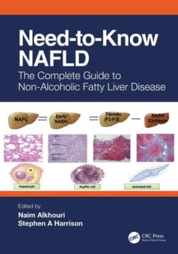 Need-to-Know NAFLD