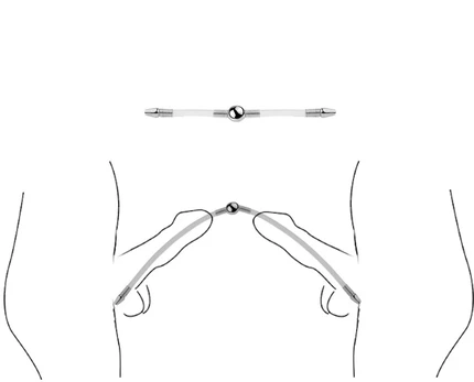 Dvigubas šlaplės dilatatorius, 15 cm