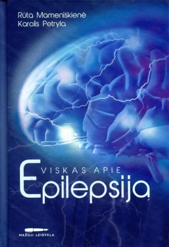 Viskas apie epilepsiją