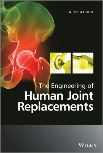 Engineering of Human Joint Replacements