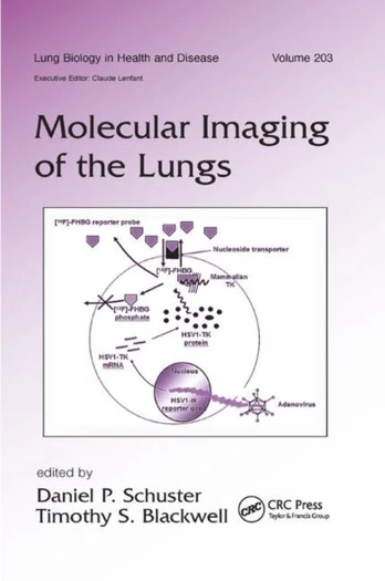 Molecular Imaging of the Lungs