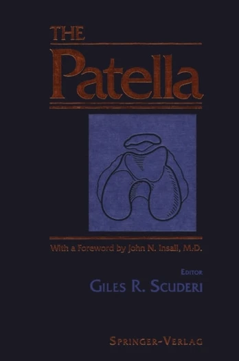 Patella