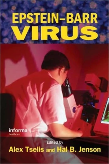 Epstein-Barr Virus