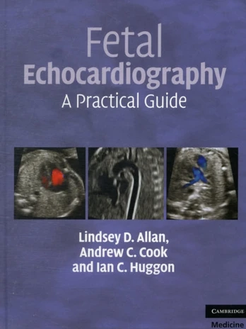 Fetal Echocardiography
