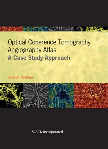Optical Coherence Tomography Angiography Atlas
