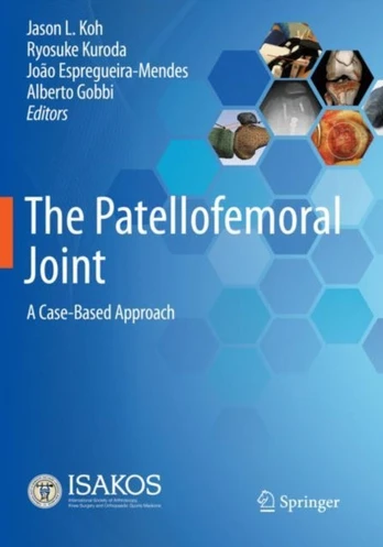 Patellofemoral Joint