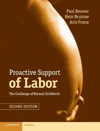 Proactive Support of Labor