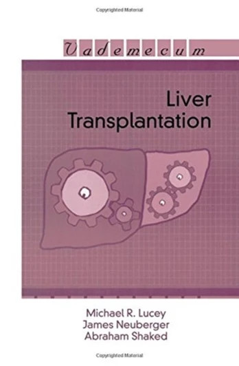 Liver Transplantation