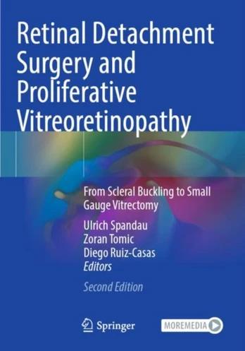 Retinal Detachment Surgery and Proliferative Vitreoretinopathy
