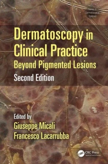Dermatoscopy in Clinical Practice