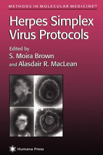Herpes Simplex Virus Protocols