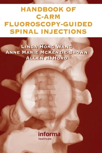 Handbook of C-Arm Fluoroscopy-Guided Spinal Injections