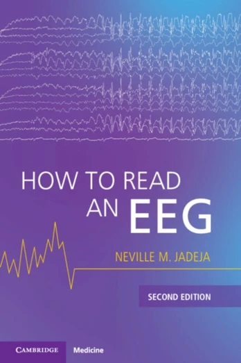 How to Read an EEG
