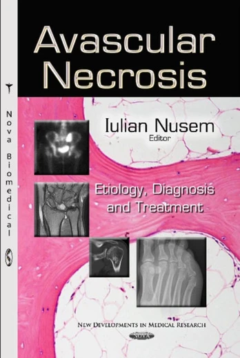 Avascular Necrosis