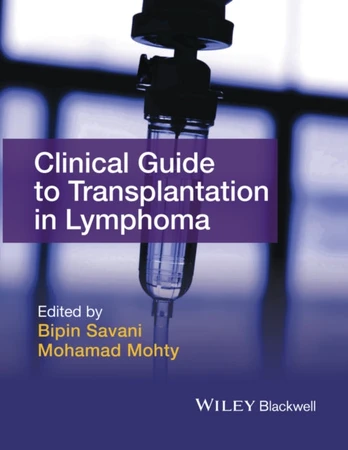 Clinical Guide to Transplantation in Lymphoma