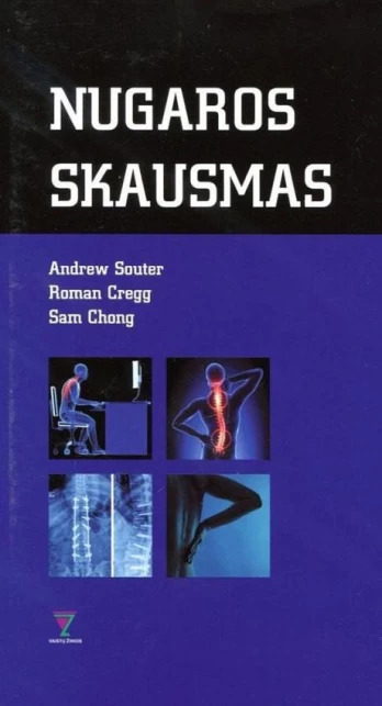 Nugaros skausmas