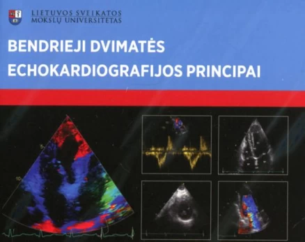 Bendrieji dvimatės echokardiografijos principai