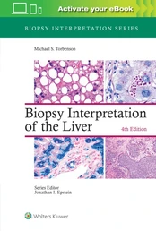 Biopsy Interpretation of the Liver kaina