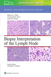 Biopsy Interpretation of the Lymph Node: Print + eBook with Multimedia kaina