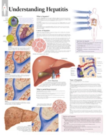Understanding Hepatitis Paper Poster