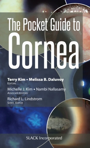 Pocket Guide to Cornea