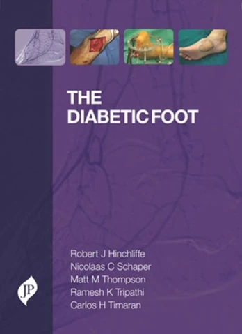 Diabetic Foot