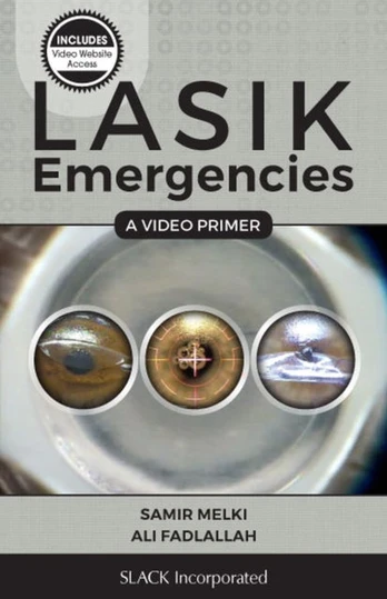 LASIK Emergencies: A Video Primer