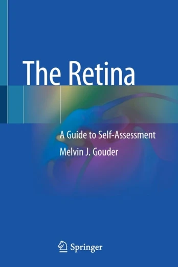 Retina