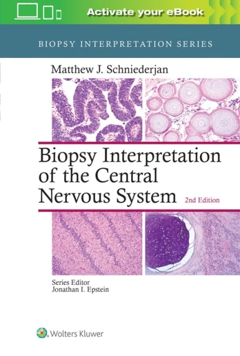 Biopsy Interpretation of the Central Nervous System