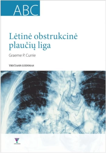 Lėtinė obstrukcinė plaučių liga