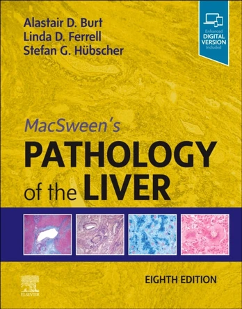 MacSween's Pathology of the Liver